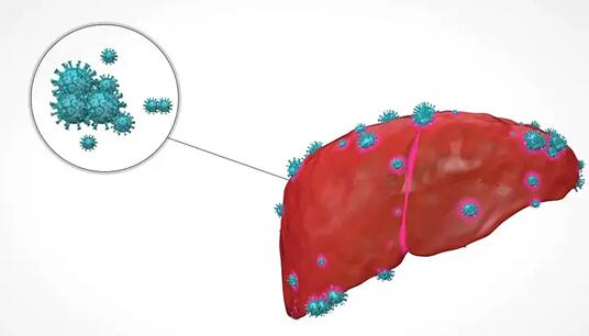 流行性肝炎图片